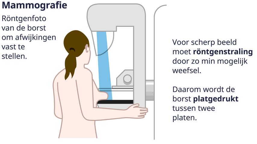 Pijnloos alternatief voor bevolkingsonderzoek borstkanker is moeilijk te vinden